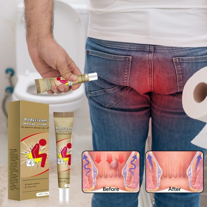 SADOER Body Cream Ointment Hemorrhoids Cream 3PCS