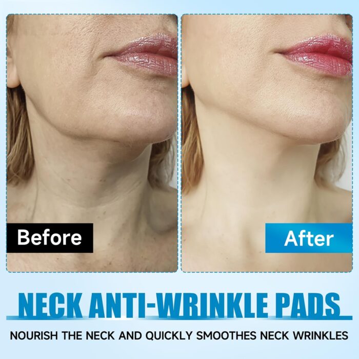 SADOER Collagen Neck Mask 5 Pack